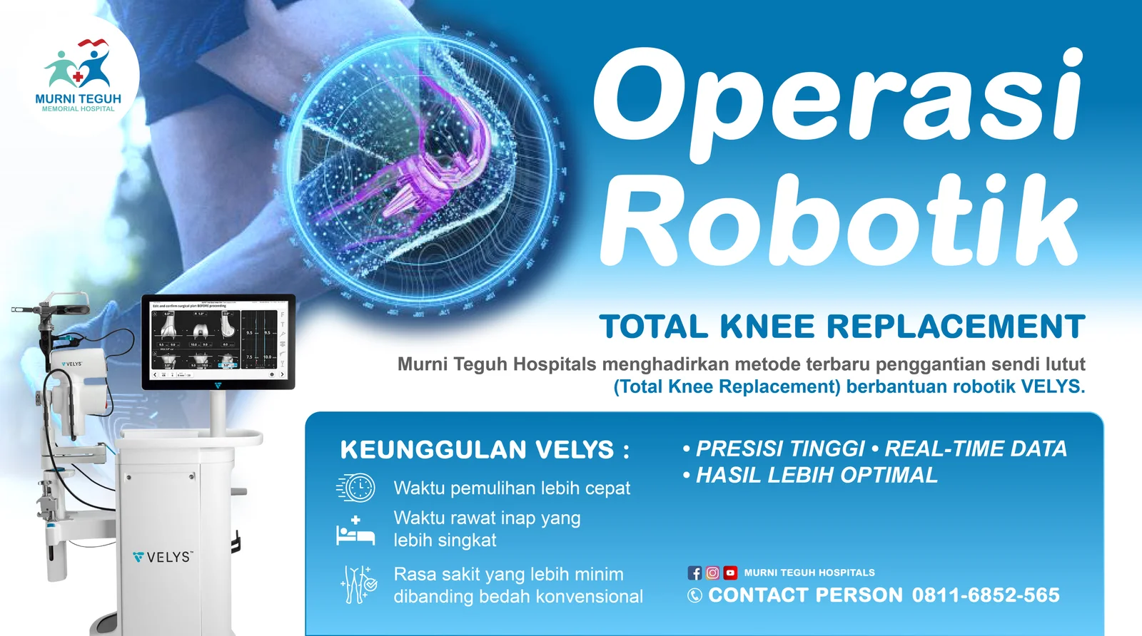 Velys Robotic